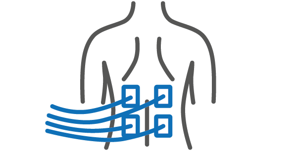 Elektromyografie